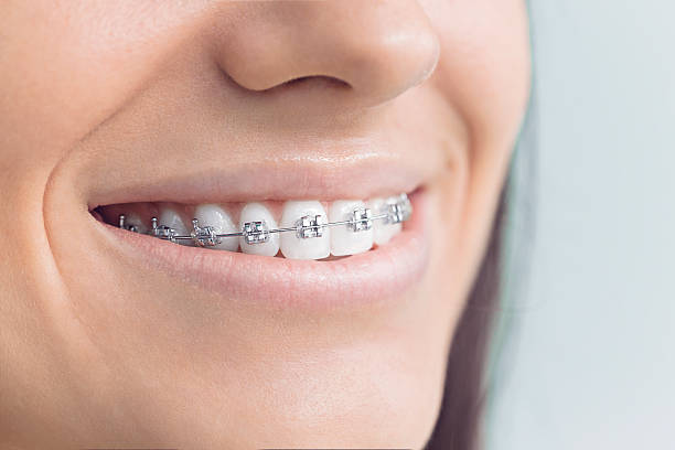 Best Invisalign and Clear Aligners  in York, PA